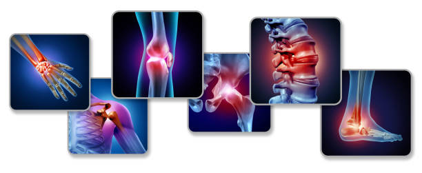 <strong>Heal Through Vibration of Shockwave Therapy for Knee Osteoarthritis </strong>